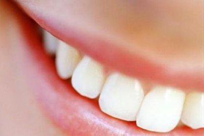 sbiancamento denti